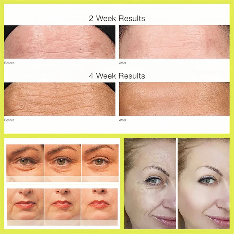 Skinuretic™ - Vita A Retinal Shot Tightening Serum