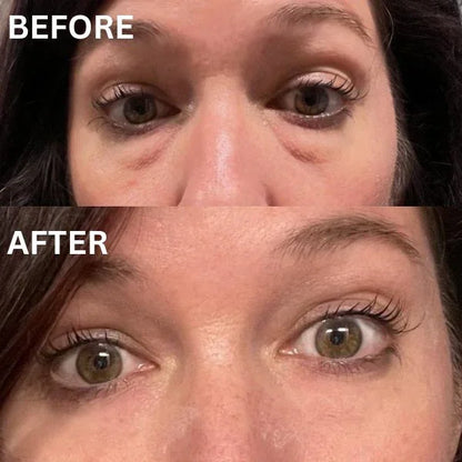 Skinuretic™ - Instant Firm Collagen Eye Patches