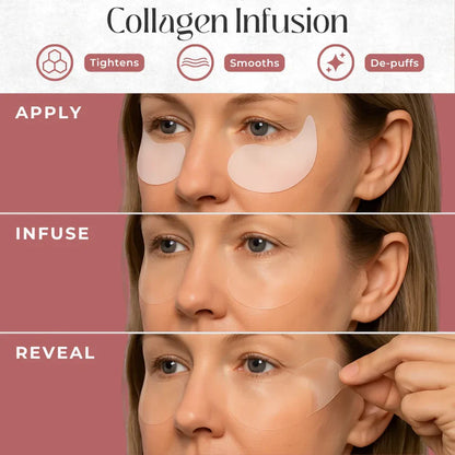 Skinuretic™ - Instant Firm Collagen Eye Patches