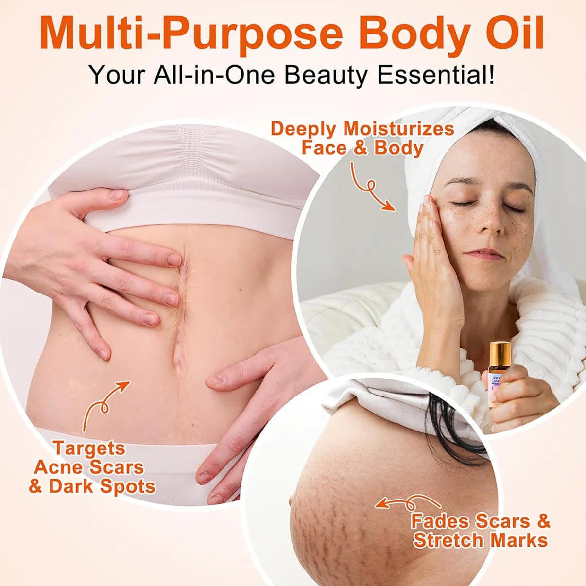 Skinuretic™ - Organic Castor Oil Roll-On