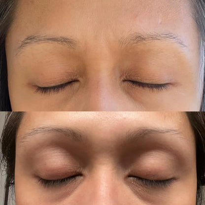 Skinuretic™ - Organic Castor Oil Roll-On