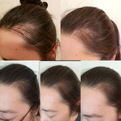 Skinuretic™ - Organic Castor Oil Roll-On