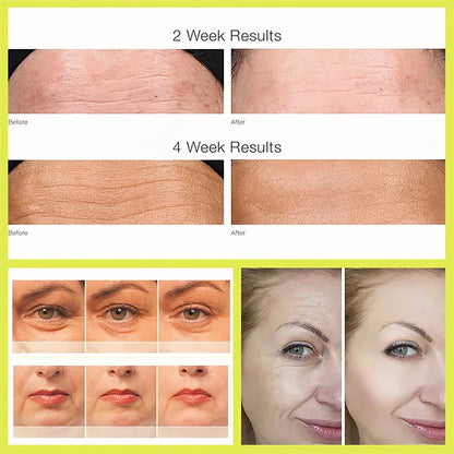 Skinuretic™ - Vita A Retinal Shot Tightening Booster